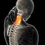 Причины боли в шее и их устранение